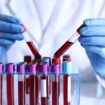 Próbki krwi w laboratorium podczas badań PFAS – Zeeland